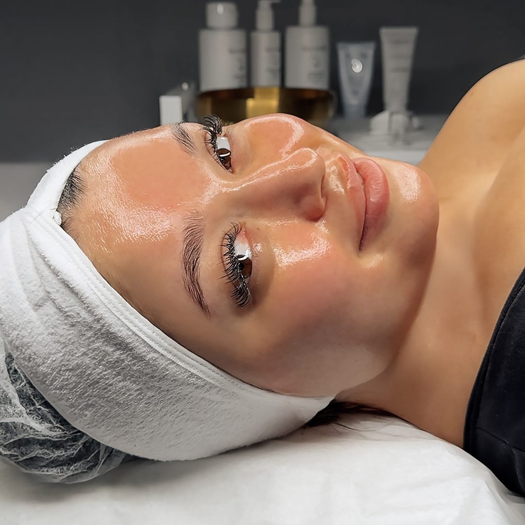 Acne Facial  to Glass